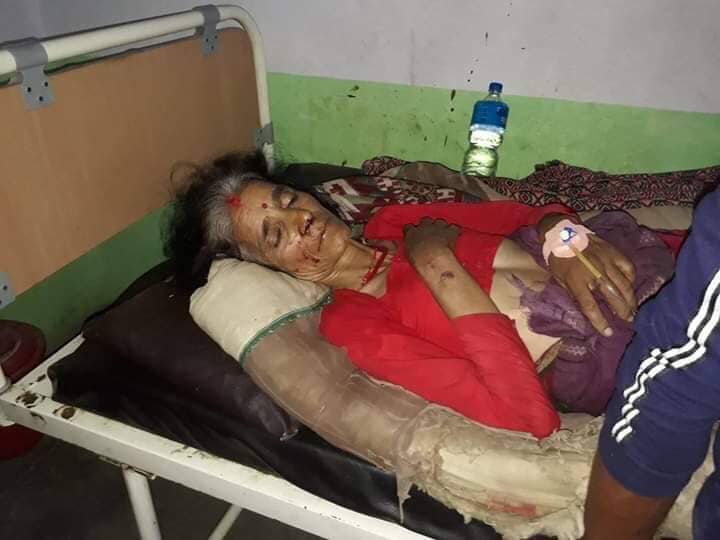 अपडेट : हावाहुरीबाट ज्यान जानेको संख्या २ पुग्यो, करिब १०० घाइतेको उपचार हुँदै